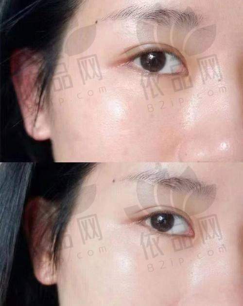 总结