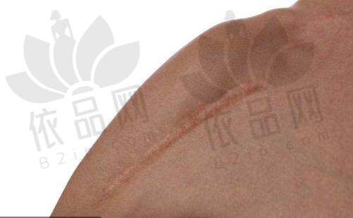 哈尔滨双举疤痕专科宋天成医生——预约方式