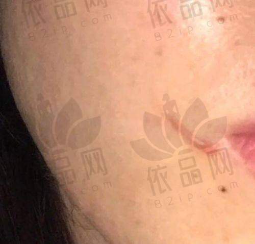 三、吉大一院整形科擅长项目介绍