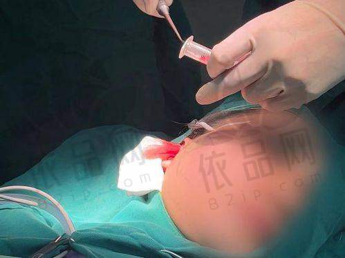 二、闭眼选这6家！北京异物取出医院红黑榜