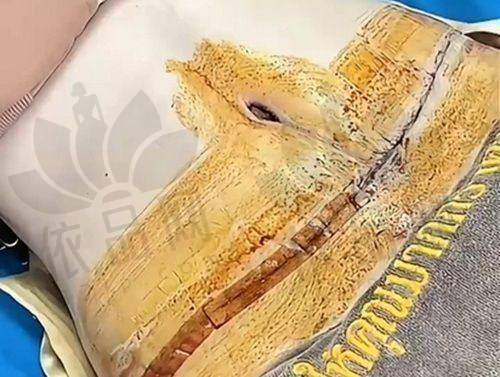 哈尔滨臻美王丹丹医生的特色技术优势