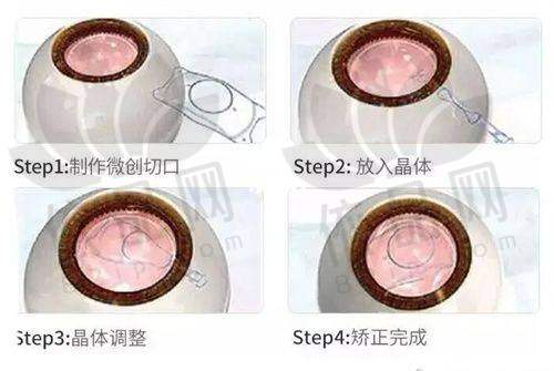 总的来说，哈尔滨明汇眼科不仅在干眼治疗方面提供了舒适、平价、效率高的雾化项目，还对儿童眼病的整体诊疗做到了细致到位。从设备环境到诊疗流程、从价格合理性到服务优化，患者在这里都能感受到安心和尊重。如果你正面临眼部干涩、视力模糊或孩子视力发育方面的问题，不妨前往哈尔滨明汇眼科做一次详细评估，医生会根据你的情况提供个性化建议。目前干眼雾化治疗475元起，也方便大家尝试基础护理型治疗。有任何疑问或就诊意向，欢迎通过法定网站进行详细询问，预约更快捷。