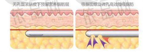 佳木斯韩艺来医疗美容医院收费价格表