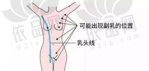 成都莱瑞拉整形黄佳涌医生特色技术优势