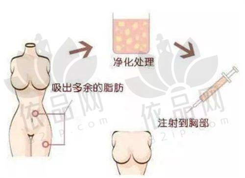 齐齐哈尔艾格医疗美容门诊部收费价格表