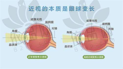 鸡西爱尔眼科医院收费价格表