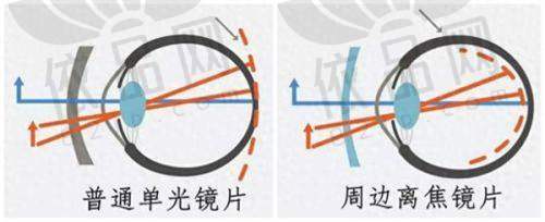 二、河南省人民医院眼科收费标准速查版（建议截图保存）