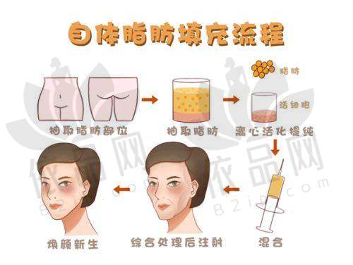 合肥维多利亚吸脂的价格范围