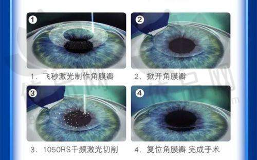 哈尔滨龙润眼科弱视治疗优势