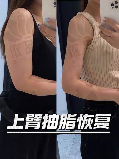 口碑背后的三重保护体系