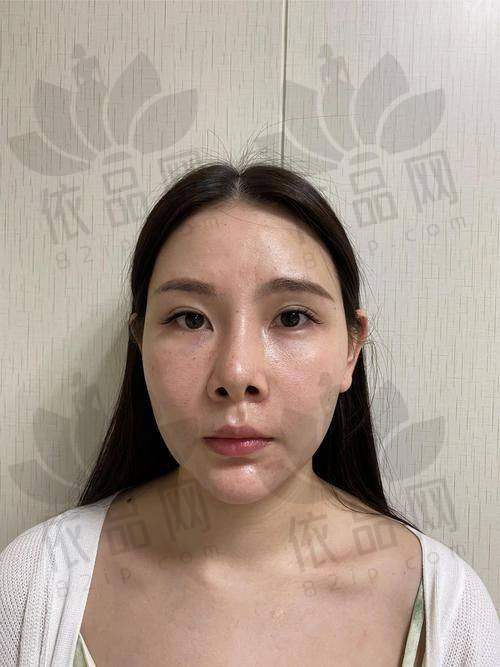 深圳艺星医疗美容医院——连锁机构，手术定制化选项多