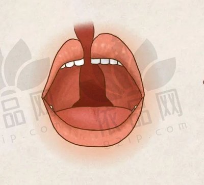 余文林是国内唇裂修复专家，多类手术精通，助患者重拾笑容与信心