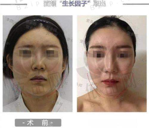 南京美贝尔美容医院正规吗