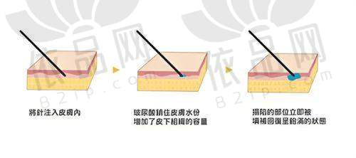 一、广东省十大整形美容医院排名前十医院，为你解答广东哪家整形美容医院好