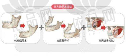 南京医科大学友谊整形外科医院医生团队
