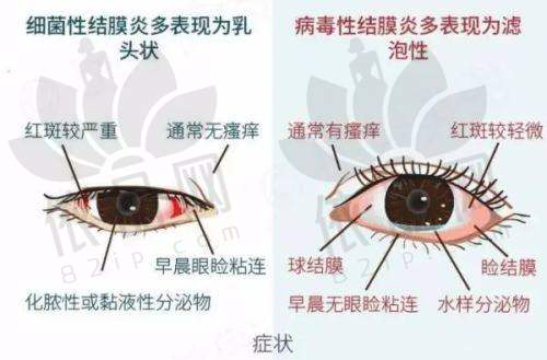 大庆爱尔眼科医院陈晓雪医生资质信息