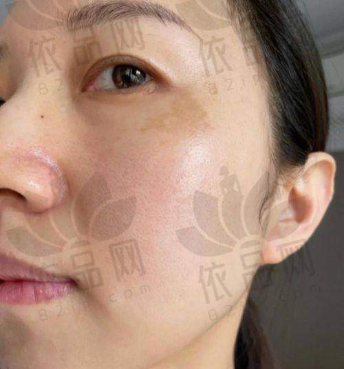 综上所述，大庆兰汀医疗美容的光子嫩肤项目具有诸多优势。精良的IPL设备和多波长复合光技术，为治疗成效提供了有力保护；专精的医生团队和个性化的服务，让每一位求美者都能得到更适合自己的治疗方案；舒适的治疗体验和合理的价格，让更多的人能够享受到光子嫩肤带来的美丽改变。而且，兰汀医疗美容还在不断发展和进步，未来的前景十分广阔。如果你也想改善肌肤问题，实现美丽梦想，不妨来大庆兰汀医疗美容体验一下光子嫩肤项目，相信你一定会爱上这里。