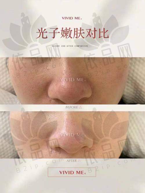 总结