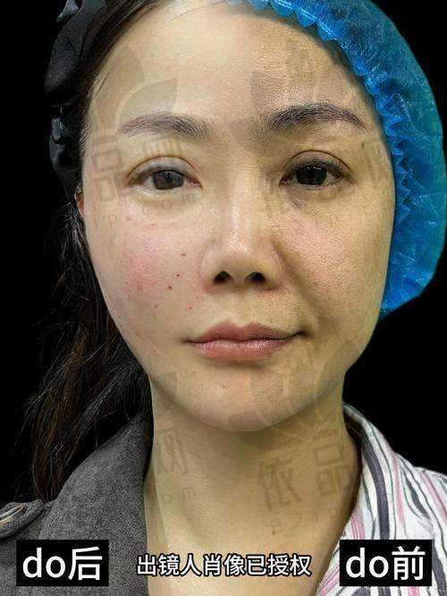 牡丹江君美施整形馒化脸修复的优势