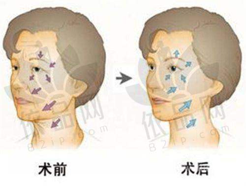 预约方式