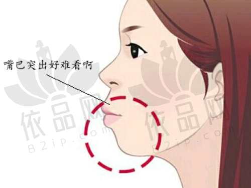 二、胸部奥美定取出挂哪个科室？整形外科or乳腺外科