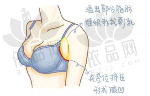 总结