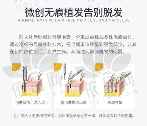 南京菲丝医疗植发门诊部正规吗