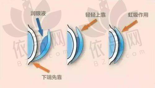 鲍连云医生特色技术优势