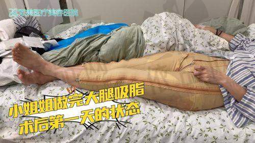 术后护理注意事项