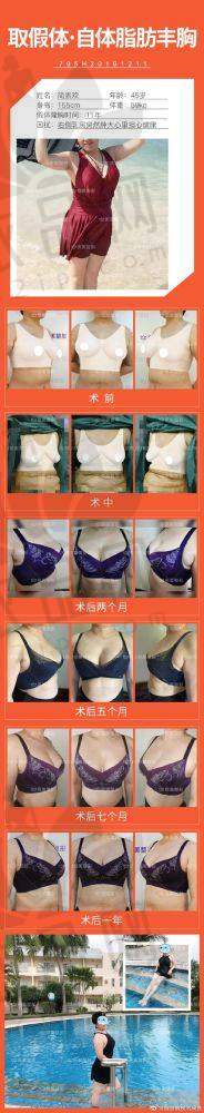 总结