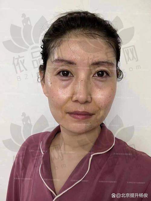 南京友谊贺小虎微拉美项目价格