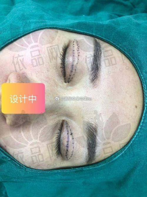 真实的修复实例