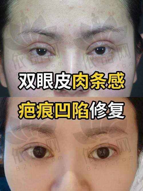 独特的修复技术