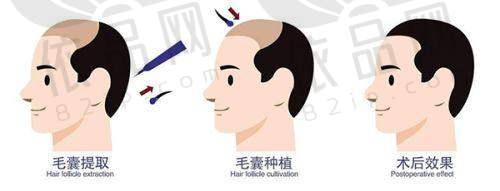 湛江韩美整形医院正规吗？连锁背景稳扎稳打