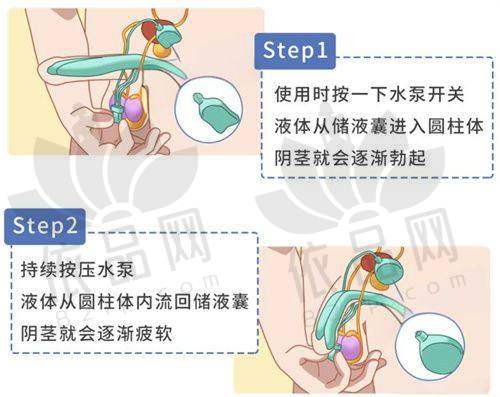 深圳艺星医疗美容医院：连锁品牌，审美风格稳定
