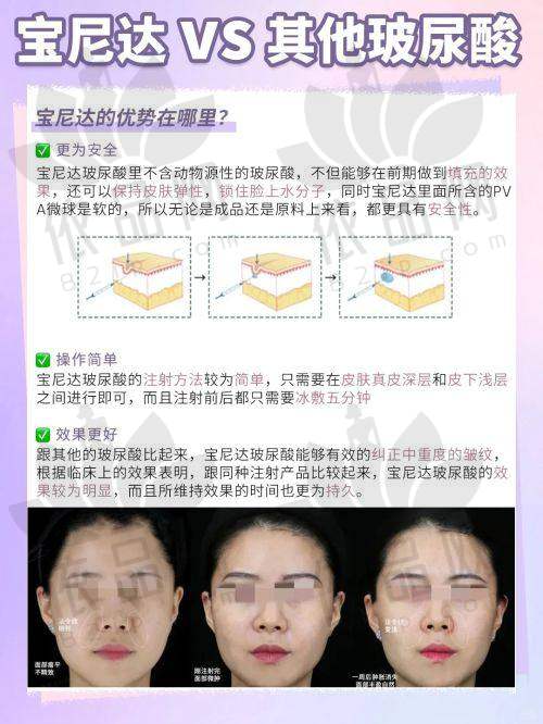 内轮廓苹果肌复位提升：自然抗衰的秘密武器