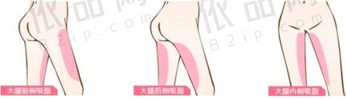 上海九院疤痕修复科费用构成说明
