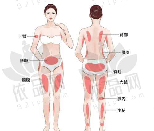 二、大腿吸脂的需求与现状