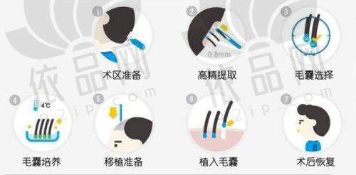 江阴首佳植发美容诊所收费价格表
