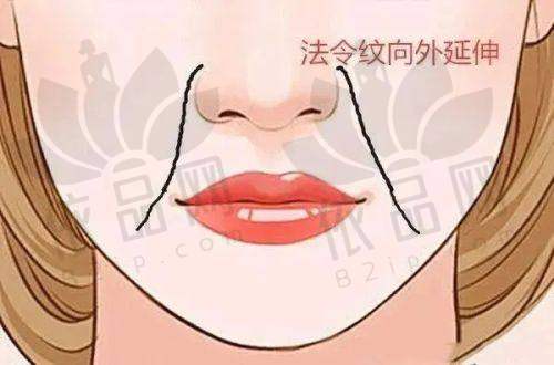 曼谷有名整形医院排名中的泰国暹罗娜整容医院