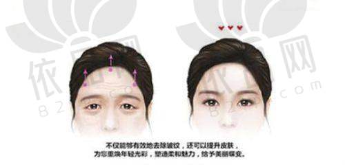 南京伊而菲斯胡勇鼻部综合整形的实例分享