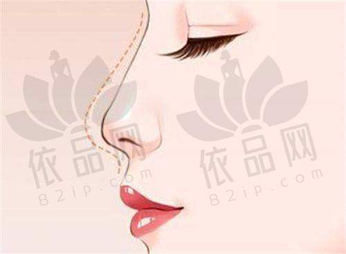 总结