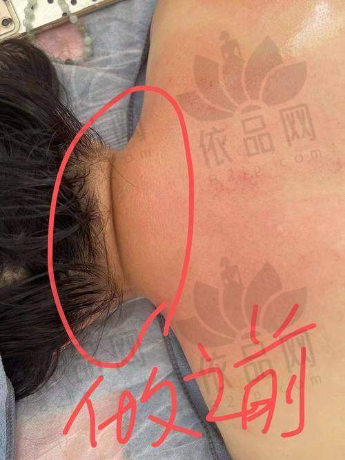四、温州徐淑卿医生口碑良好