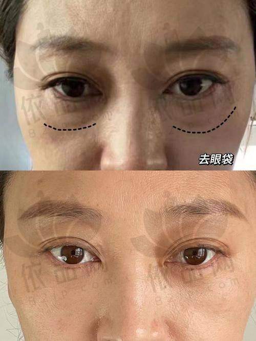 三、手术过程与术后修复