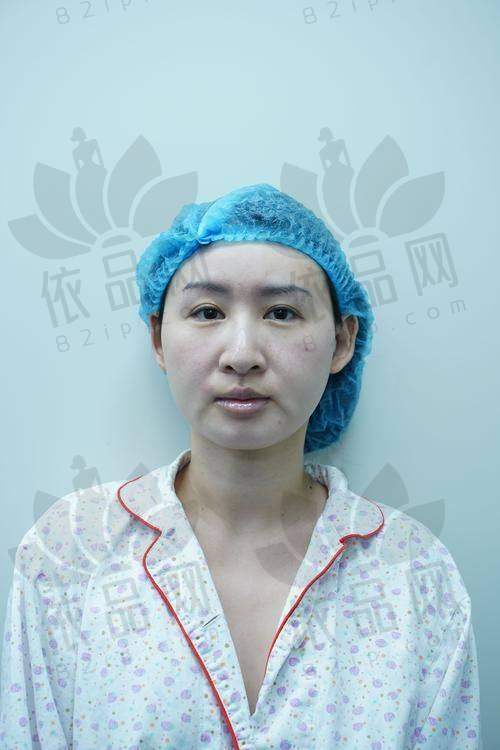 三、手术成效