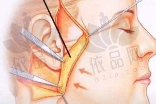 无锡丽都整形医院口碑怎么样？综合实力强、患者评价优，在无锡排名前三值得信赖