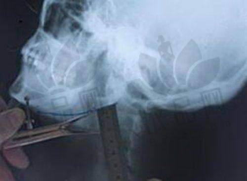 徐州予美医疗美容诊所交通路线