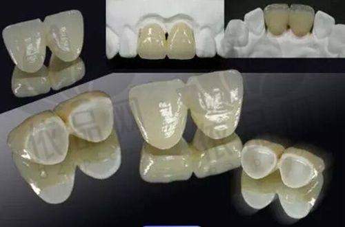 蔡宗泽：特色技术优势