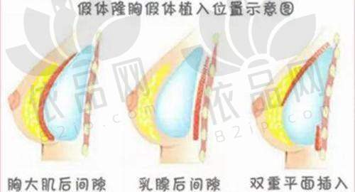 无锡坤如玛丽整形医院和爱思特就医环境与服务