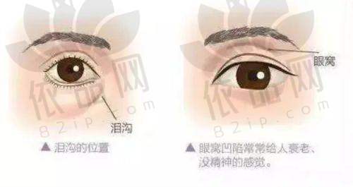 六、术前术后注意事项